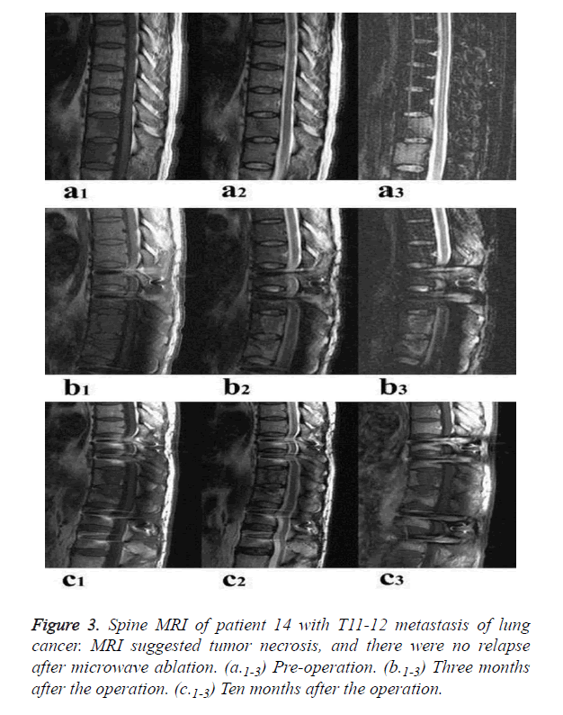 biomedres-Spine-MRI