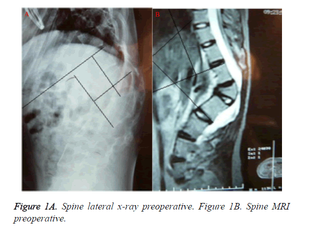 biomedres-Spine-lateral-x-ray