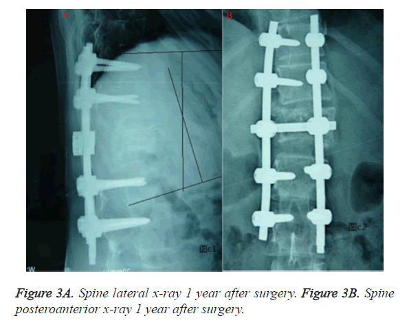 biomedres-Spine-lateral-x-ray