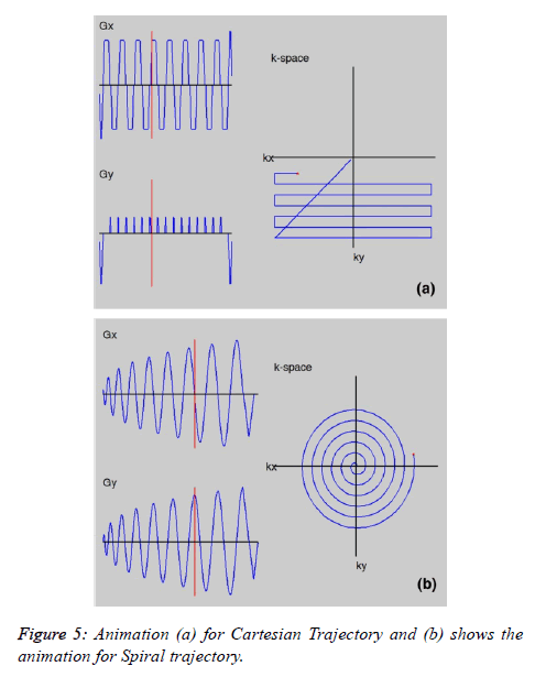 biomedres-Spiral-trajectory