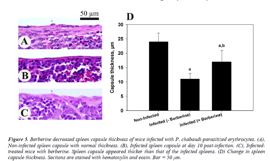 biomedres-Spleen-capsule