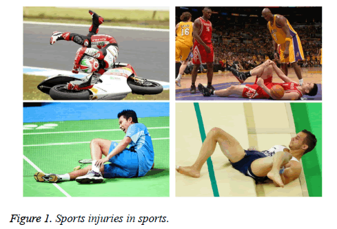 biomedres-Sports-injuries