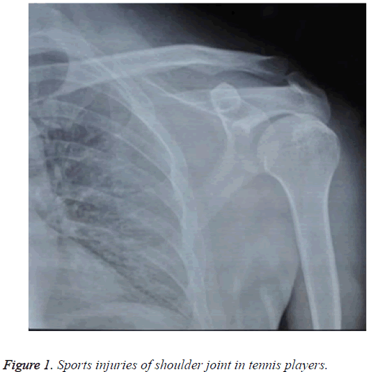 biomedres-Sports-injuries-shoulder