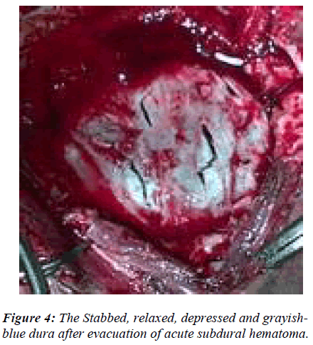 biomedres-Stabbed-relaxed-depressed