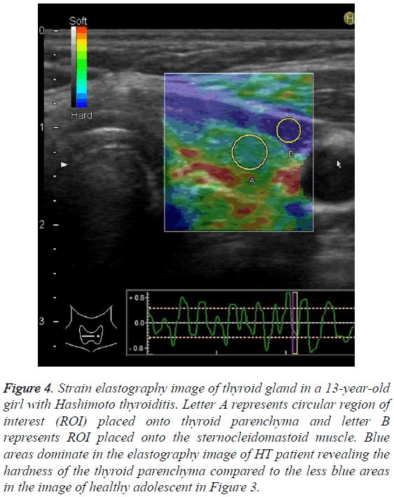 biomedres-Strain-elastography