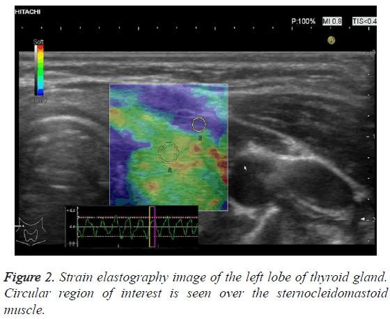 biomedres-Strain-elastography-image