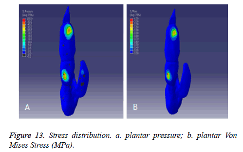 biomedres-Stress-distribution