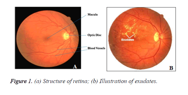 biomedres-Structure-retina