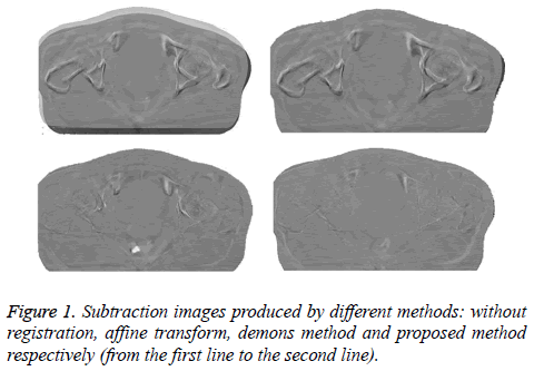 biomedres-Subtraction-images