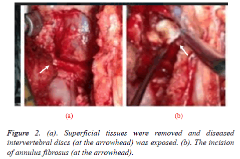 biomedres-Superficial-tissues