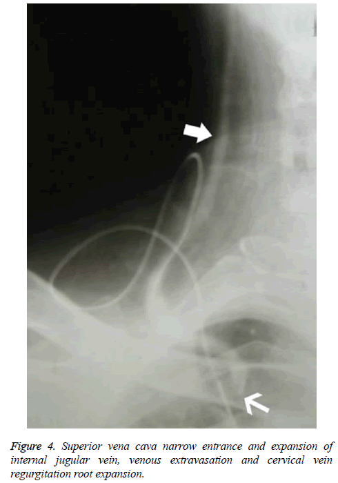 biomedres-Superior-vena