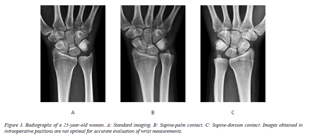 biomedres-Supine-palm