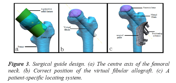 biomedres-Surgical-guide