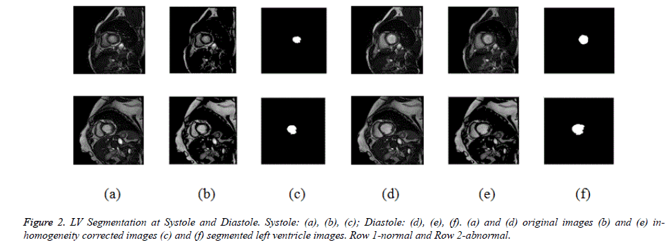 biomedres-Systole-Diastole