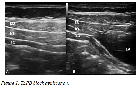 biomedres-TAPB-block