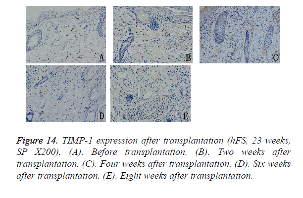 biomedres-TIMP-1-expression