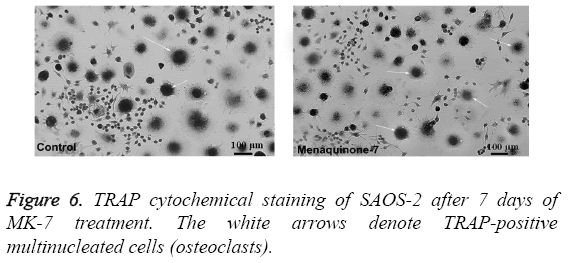 biomedres-TRAP-cytochemical-staining