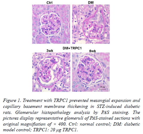 biomedres-TRPC1-prevented-mesangial