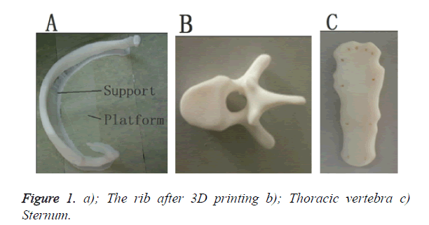 biomedres-Thoracic-vertebra