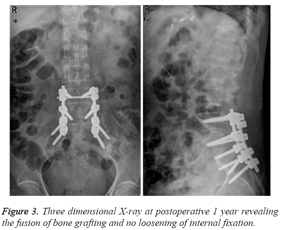biomedres-Three-dimensional-X-ray