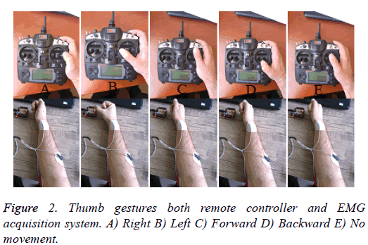 biomedres-Thumb-gestures