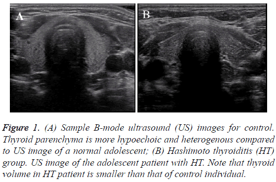 biomedres-Thyroid-parenchyma