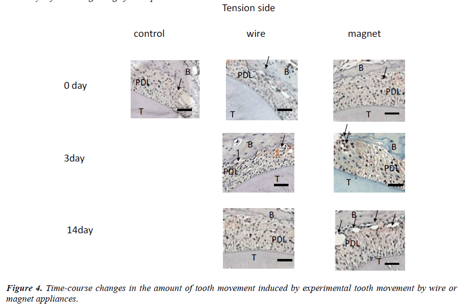 biomedres-Time-course-changes-amount-tooth-movement