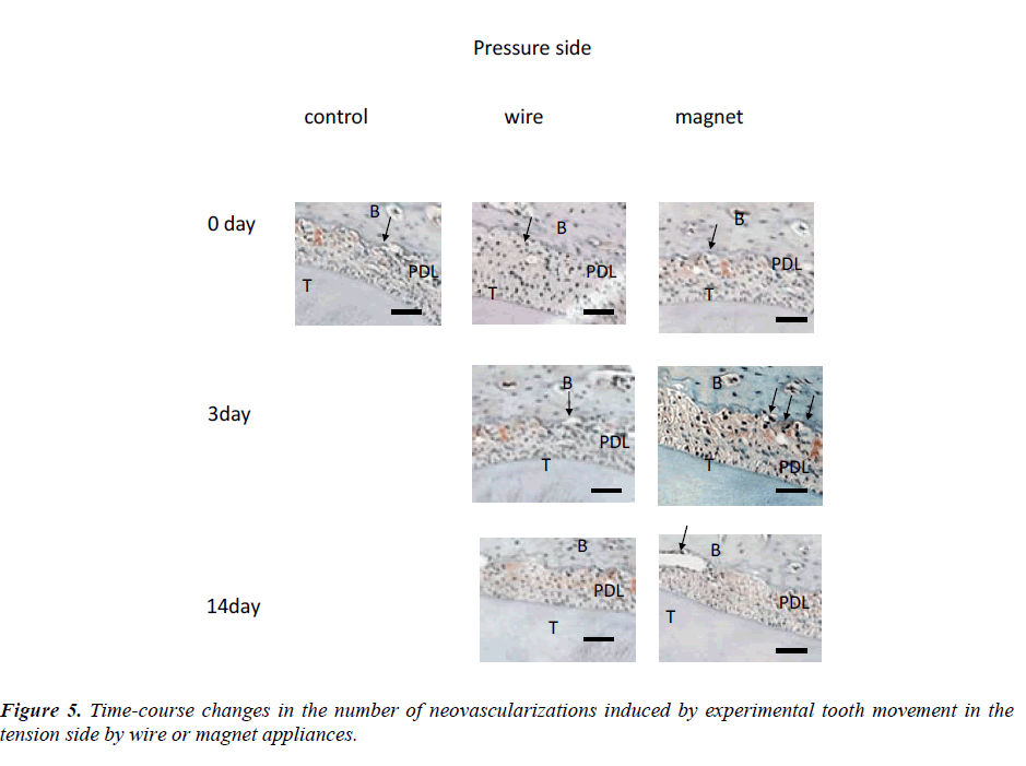 biomedres-Time-course-changes-number-neovascularizations