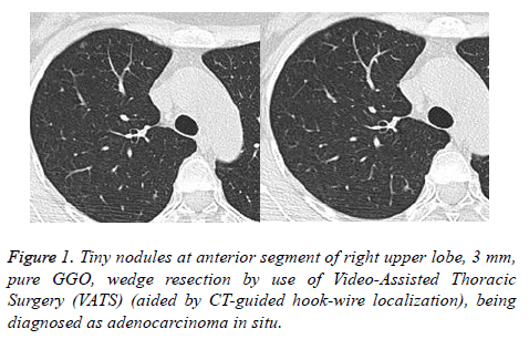 biomedres-Tiny-nodules