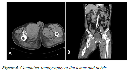 biomedres-Tomography-femur