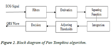 biomedres-Tompkins-algorithm