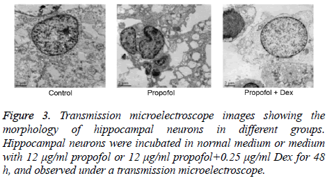 biomedres-Transmission-microelectroscope