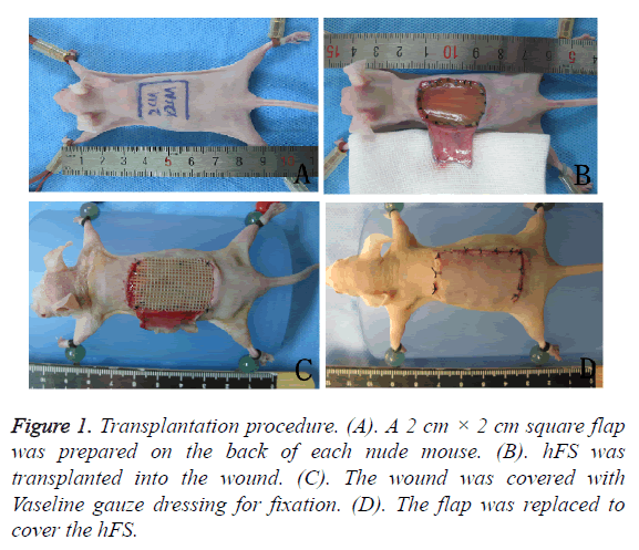 biomedres-Transplantation-procedure