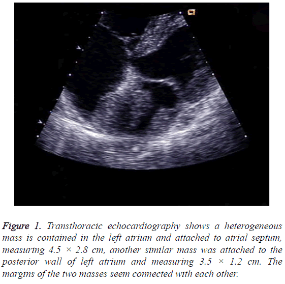 biomedres-Transthoracic-echocardiography