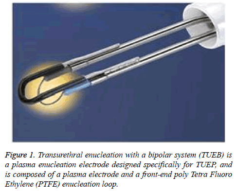 biomedres-Transurethral-enucleation