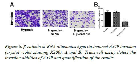 biomedres-Transwell-assay