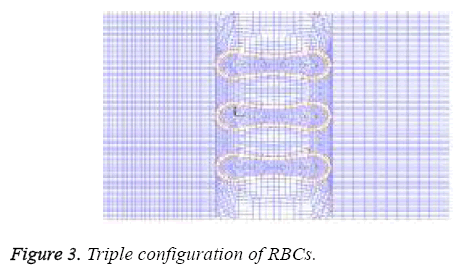 biomedres-Triple-configuration-RBC