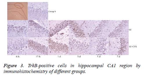 biomedres-TrkB-positive