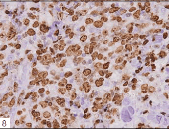 biomedres-Tumor-cells