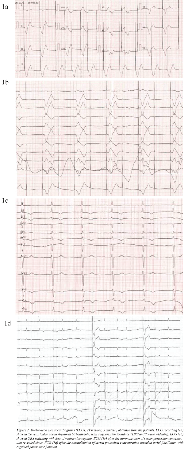 biomedres-Twelve-lead-electrocardiograms