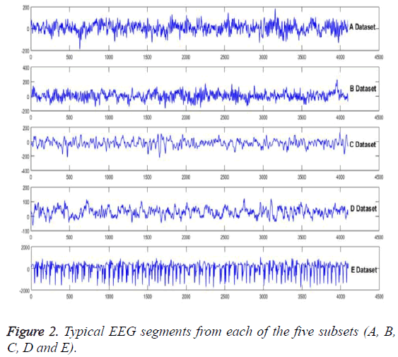 biomedres-Typical-EEG-segments