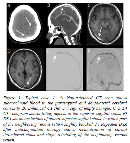 biomedres-Typical-case