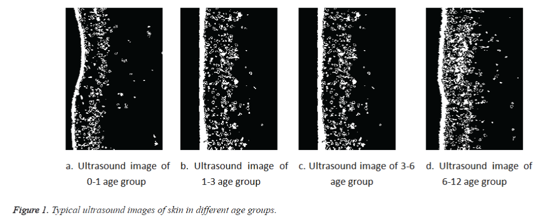 biomedres-Typical-ultrasound-images