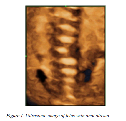 biomedres-Ultrasonic-image