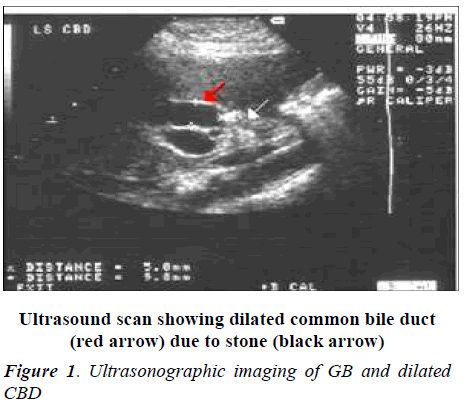 biomedres-Ultrasonographic-imaging-dilated