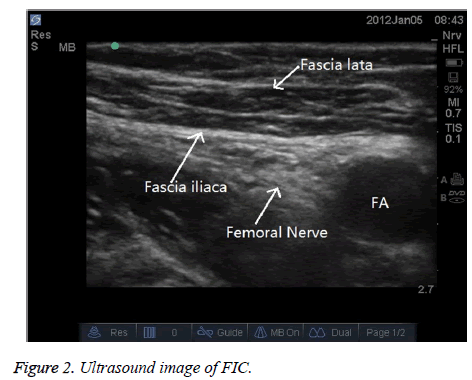 biomedres-Ultrasound-image