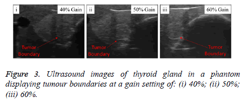 biomedres-Ultrasound-images