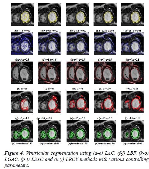 biomedres-Ventricular-segmentation