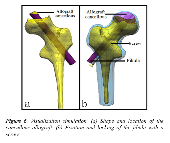 biomedres-Visualization-simulation