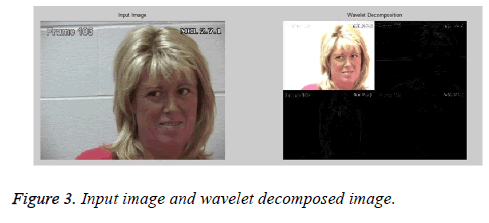 biomedres-Wavelet-decomposed